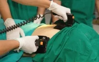 Defibrillator Paddles on Patient