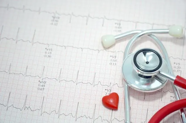 Stethoscope and mini heart on ekg / ecg paper background