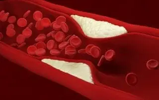 Recognizing and Treating Heart Blocks