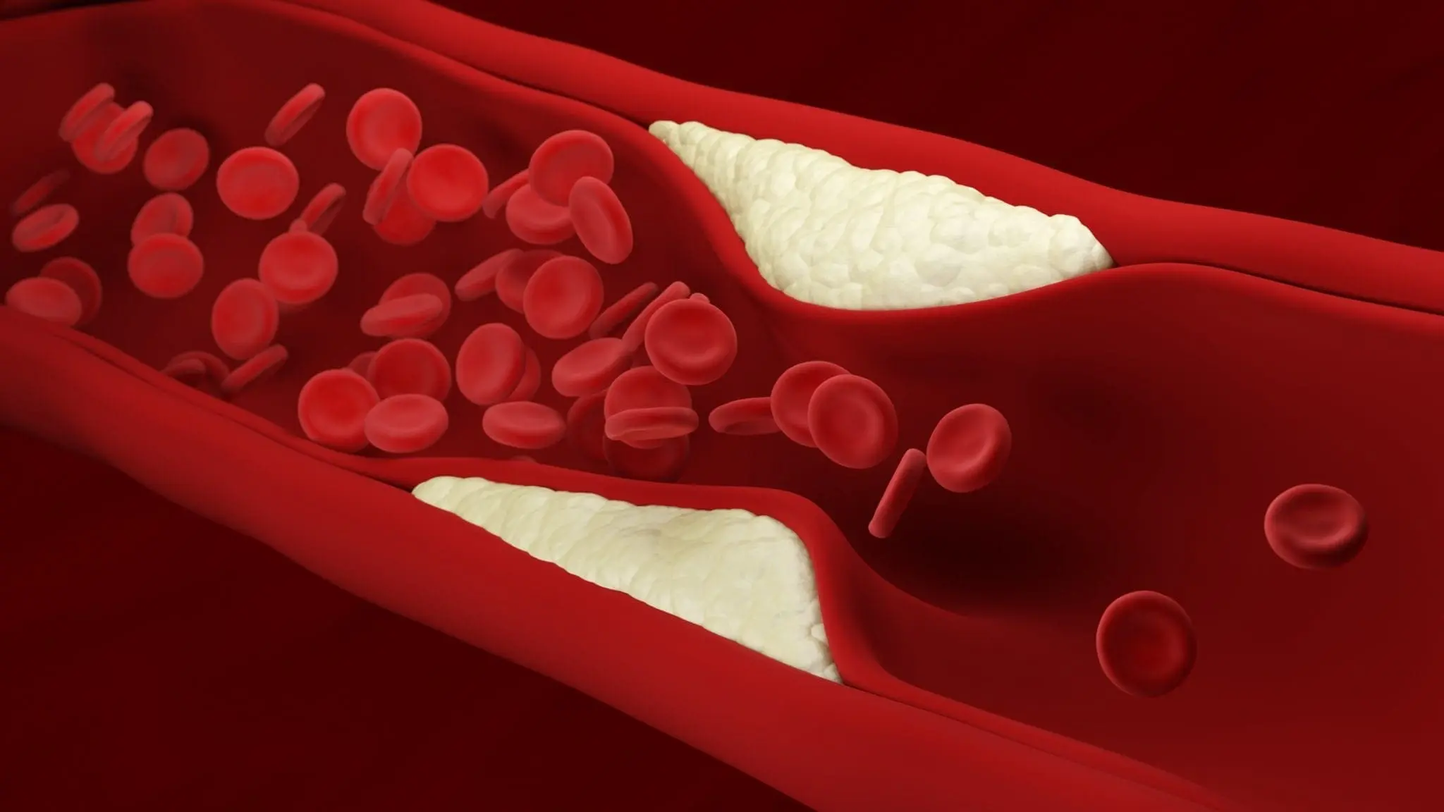 Recognizing and Treating Heart Blocks