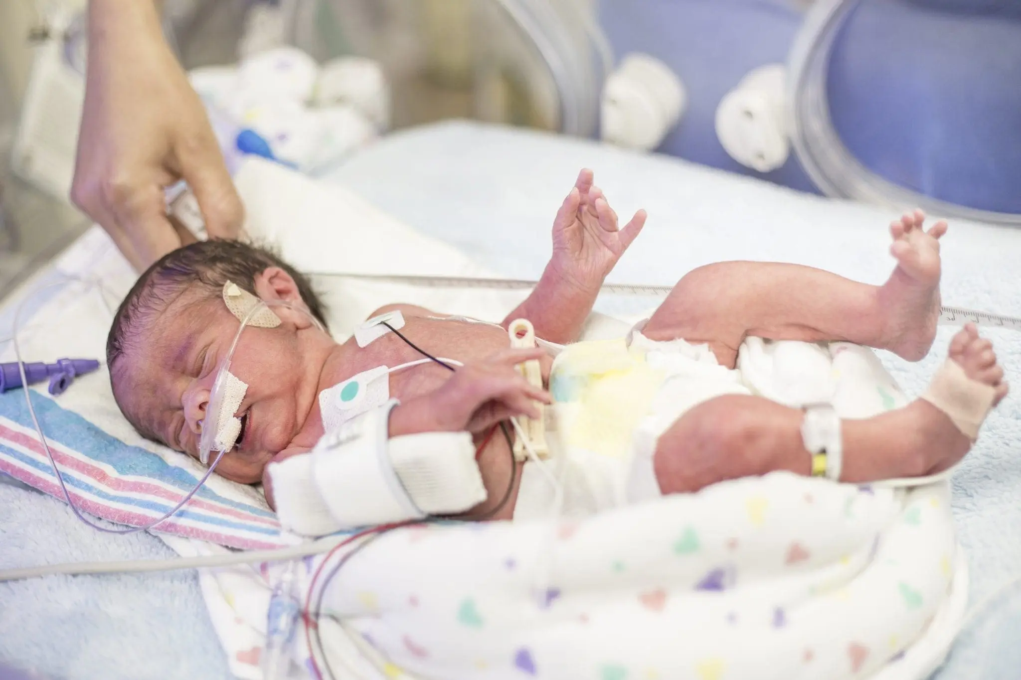 understanding nicu and how to care for fragile neonatal patients