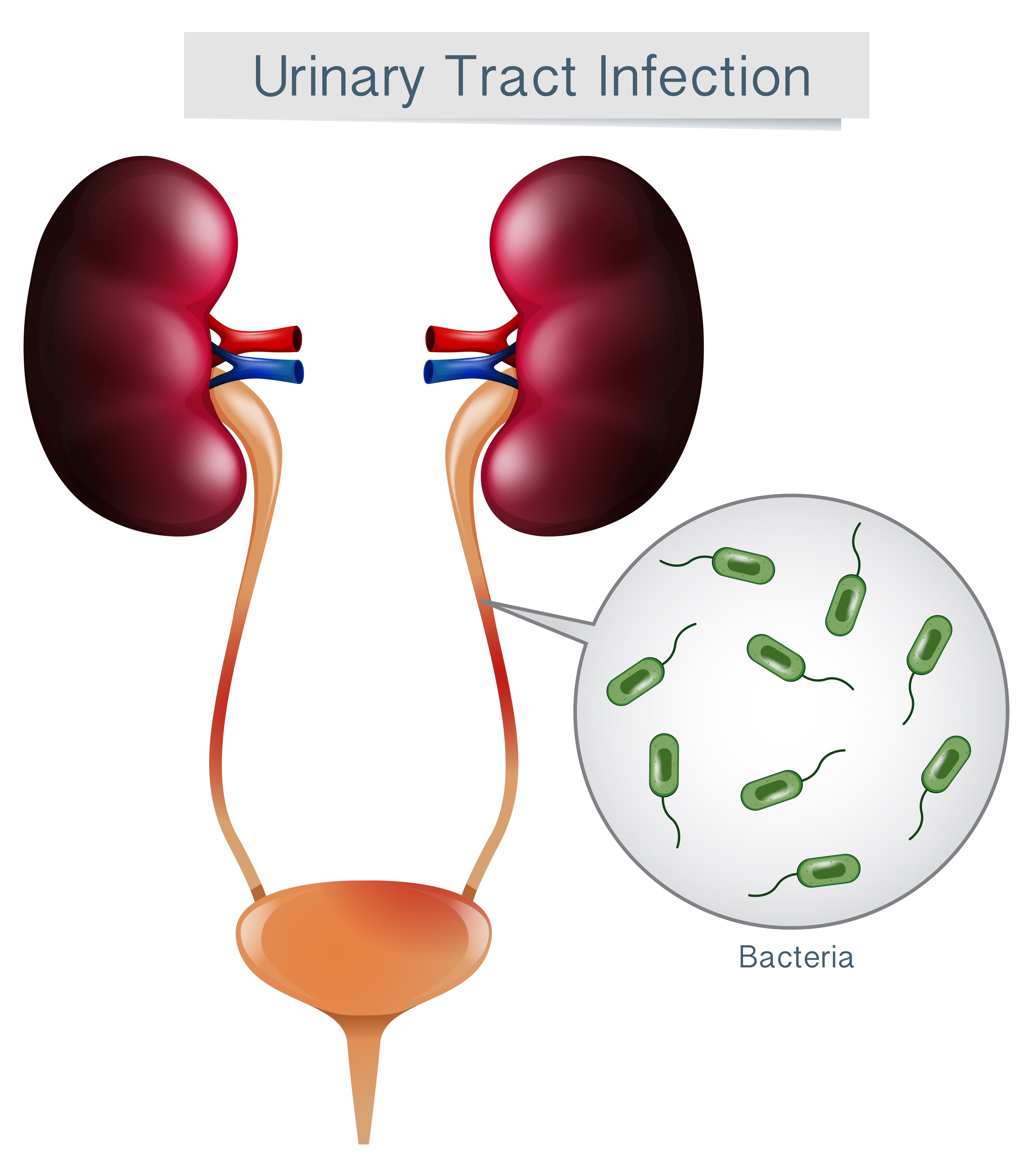 How To Prevent Urinary Tract Infections In The Elderly Project Heartbeat