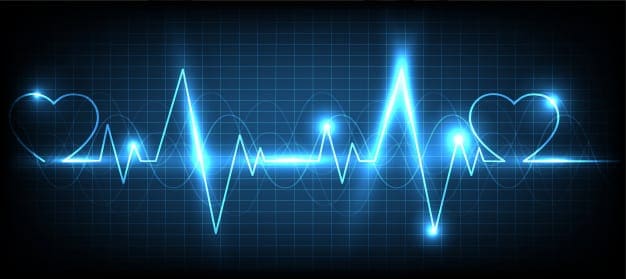 ECGs: Catching Early Signs of Myocardial Infarctions | Project Heartbeat