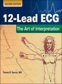12-lead-ecg-2nd-edition-book-