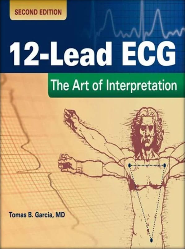 Advanced 12 Lead ECG Interpretation Certification | Project Heartbeat